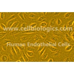 Human Primary Mammary Microvascular Endothelial Cells